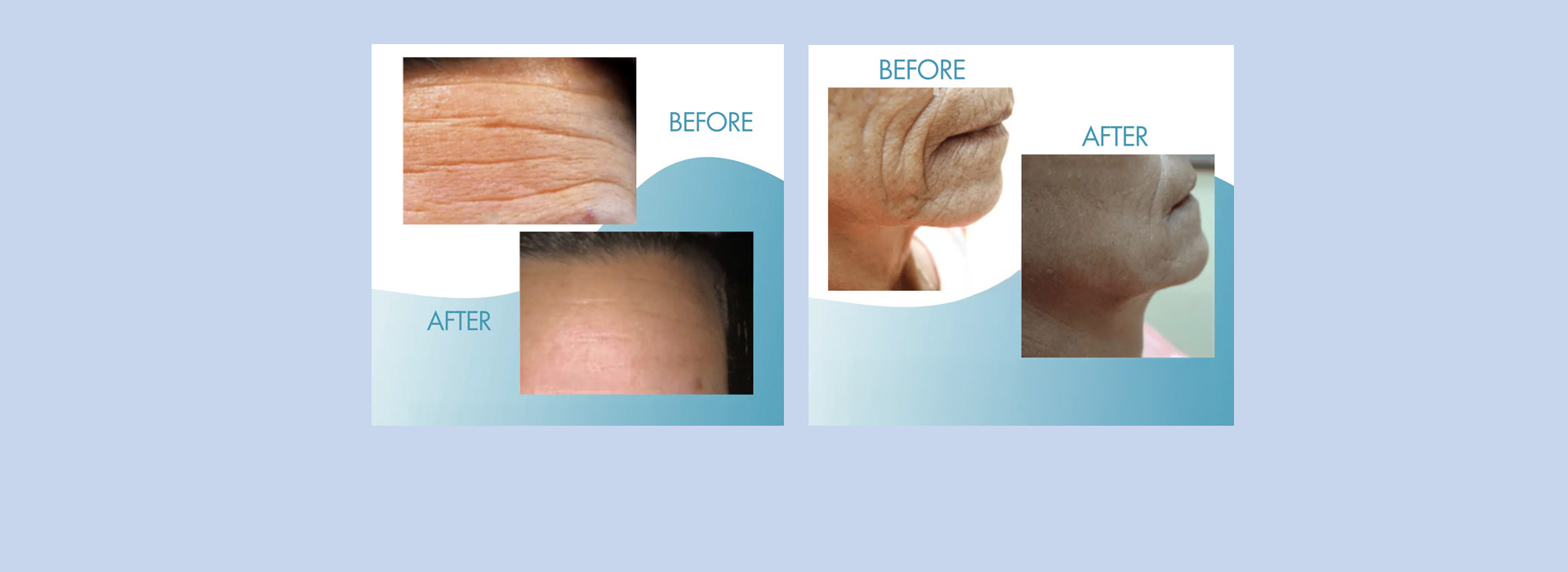 DeLand Implant Dentistry | Emergency Treatment, Ceramic Crowns and Preventative Program
