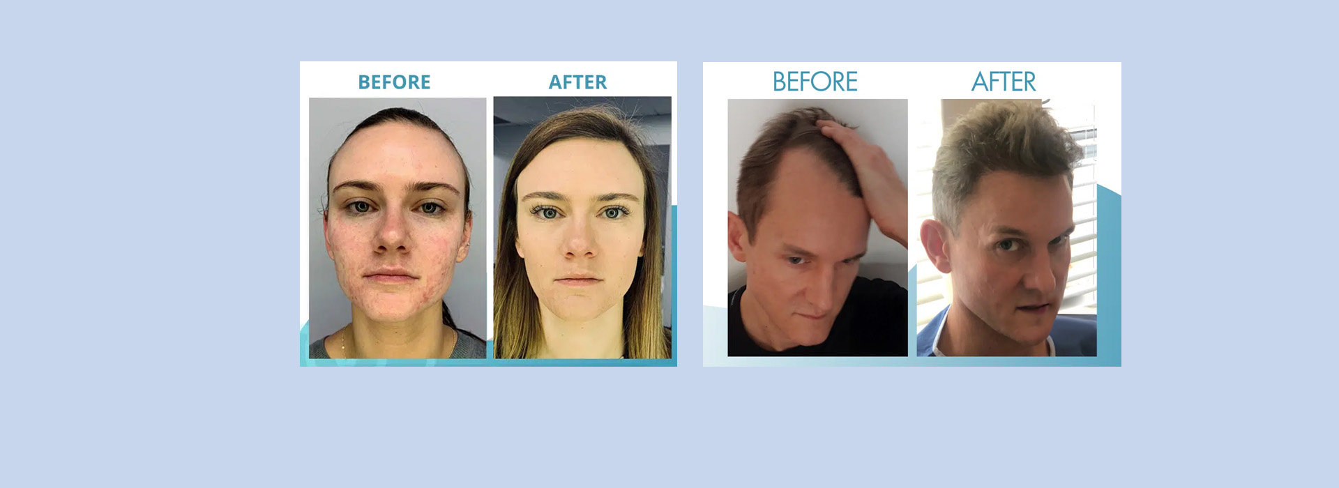 DeLand Implant Dentistry | Ceramic Crowns, Laser Therapy and Sports Mouthguards