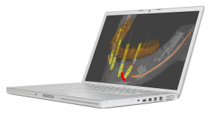 The image shows a laptop computer with its screen displaying an X-ray or medical imaging scan, which appears to be of a human body, specifically the head and neck region.