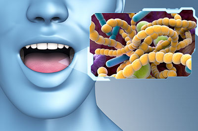 An illustration showing a human mouth with an open lower lip, accompanied by a digital graphic of a microscopic cluster of bacteria resembling a virus.