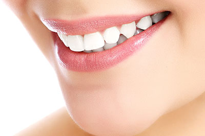 The image shows a close-up of a person s face with a focus on their teeth and lips, displaying a bright smile.