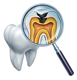 The image shows a magnified view of a tooth with an internal structure visible through a transparent section, and a magnifying glass is placed over the tooth to emphasize its close-up examination.