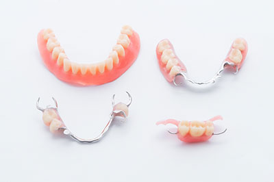 The image shows a collection of dental implants, including upper and lower sets with multiple teeth, displayed on a white background.