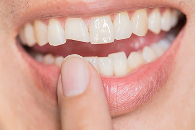 A person s hand holding a toothbrush and toothpaste, with a close-up of their mouth showing teeth brushing.