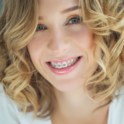 A woman with straightened teeth, smiling at the camera.