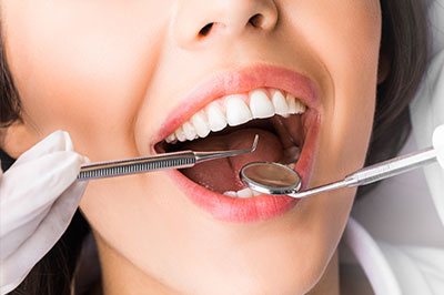 The image shows a woman with an open mouth, likely in the midst of dental treatment or preparation, with a dental drill visible near her teeth and a small amount of dental material on her lips.