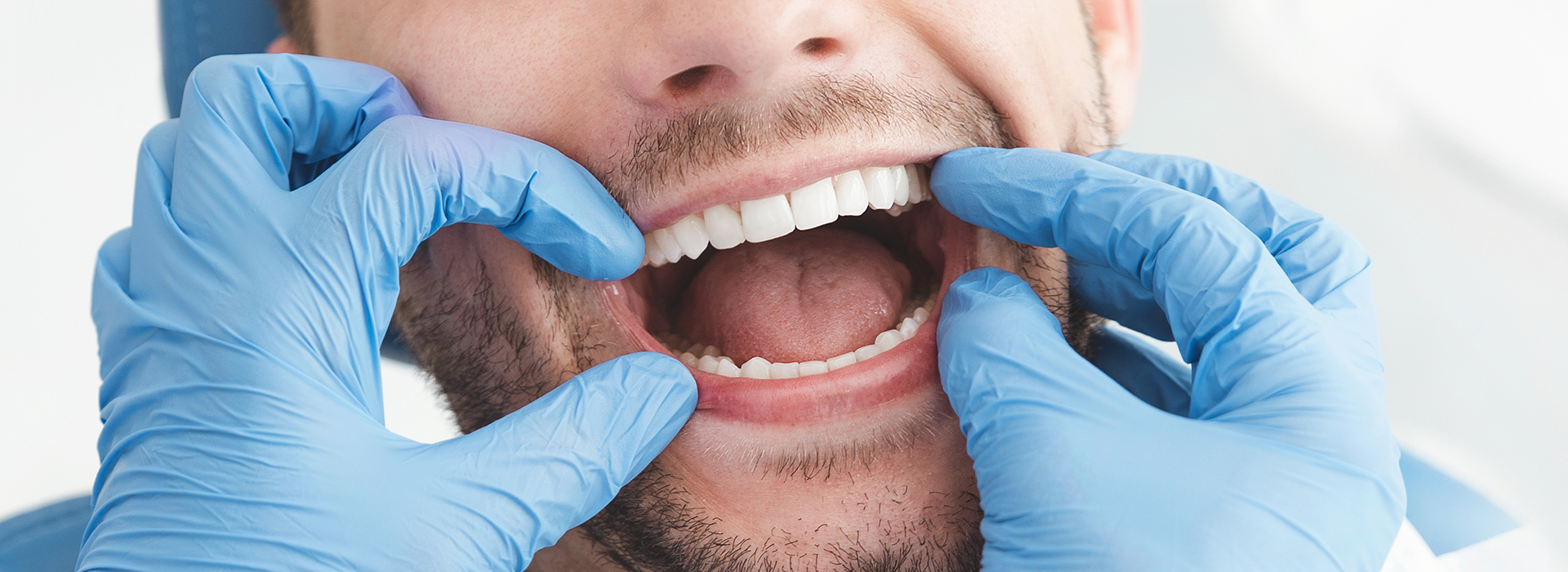 A dental professional in a blue gown and gloves, with a focus on the patient s open mouth, showcasing dental care.