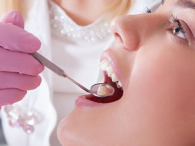 An image of a dental professional performing oral care on a patient, with the focus on the dental instruments and the patient s mouth.